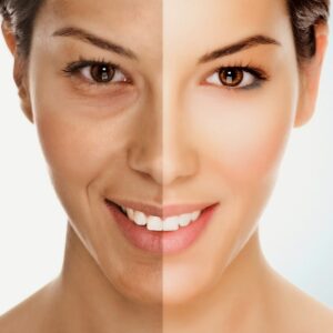 Chống lão hóa da