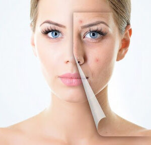 Natural White Premium - trắng da trị nám